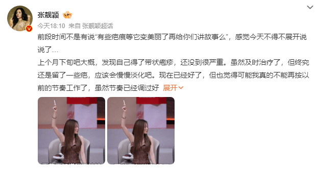 张靓颖发长文谈身体状况，自曝得带状疱疹、旧伤复发，取消跨年演唱会加场计划