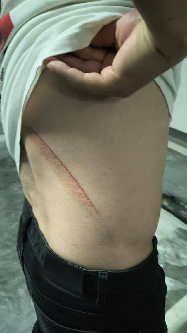 “顺子，你别去！”长沙一女子劝阻丈夫救火未果后发视频表扬：尽管摔一跤却始终冲上去